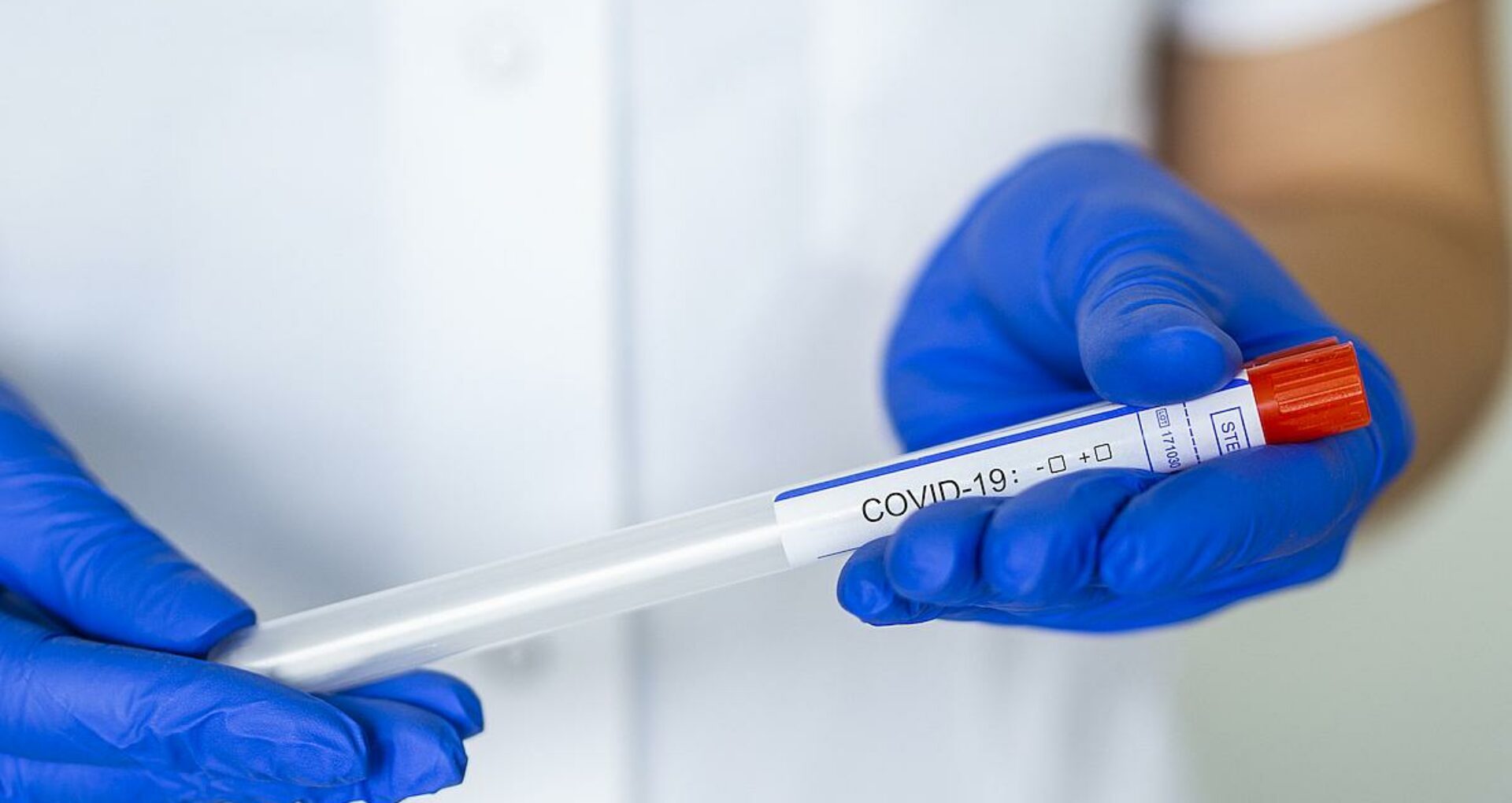 Moldova Reports 380 New Cases of Coronavirus