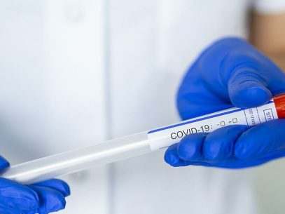 Moldova Reports 380 New Cases of Coronavirus